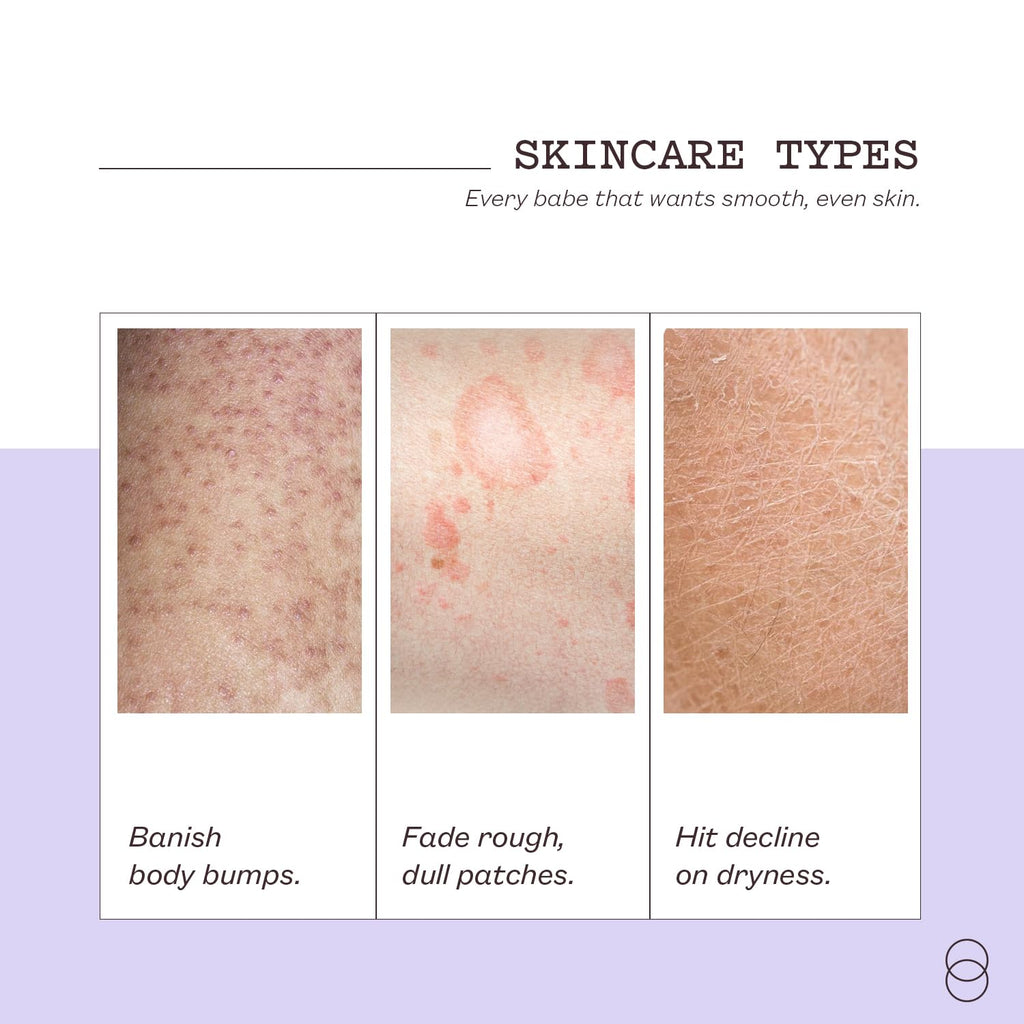 frank body Niacinamide Body Scrub (250g / 8.82 oz)