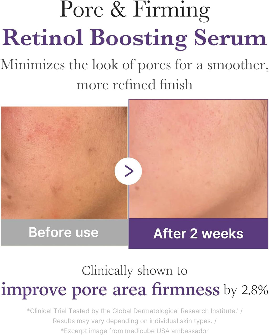 Medicube Retinol NMN Boosting Serum (30 ml)