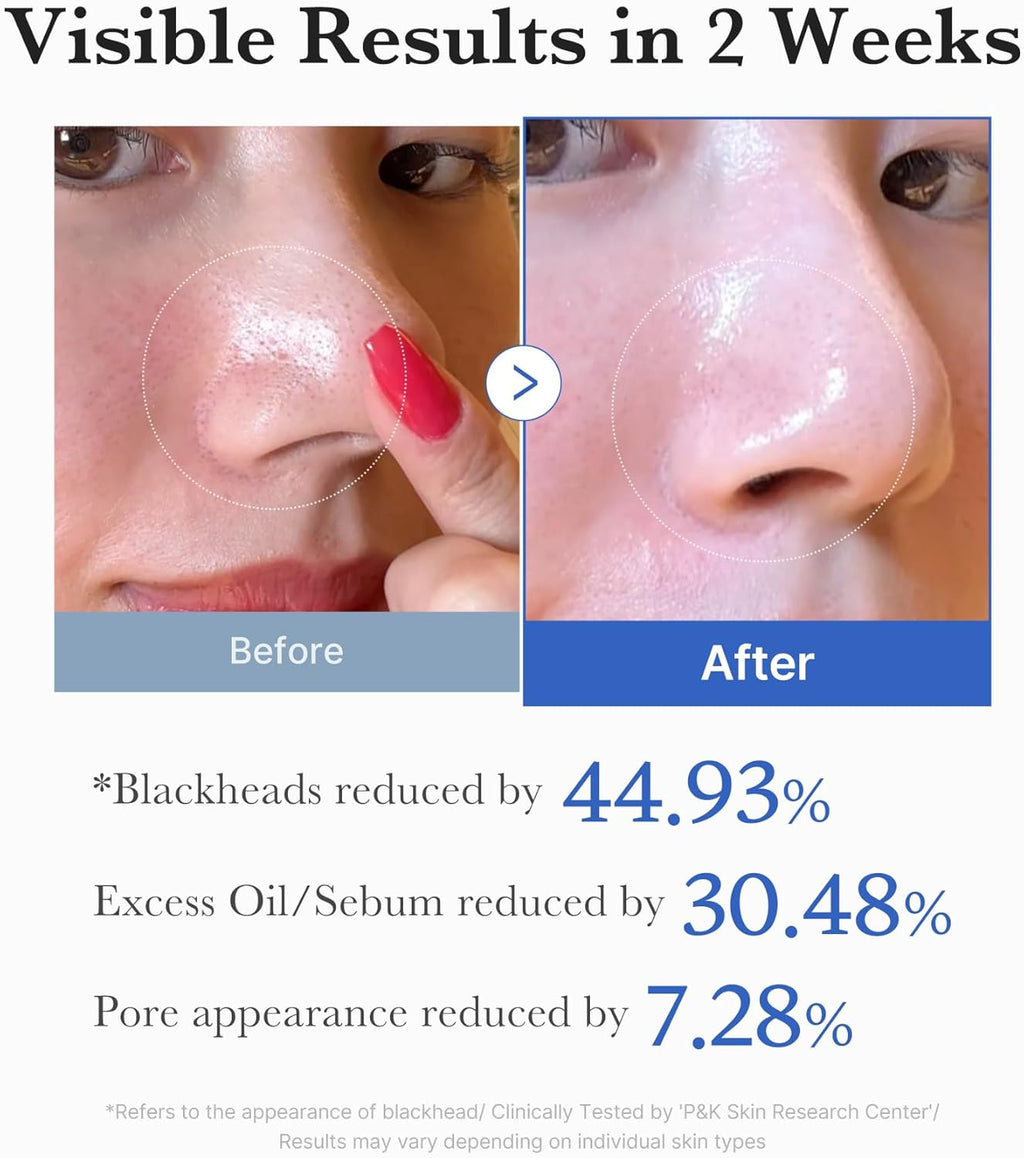 Medicube Zero Pore Pad 2.0  [2025 Version - 70 pads]