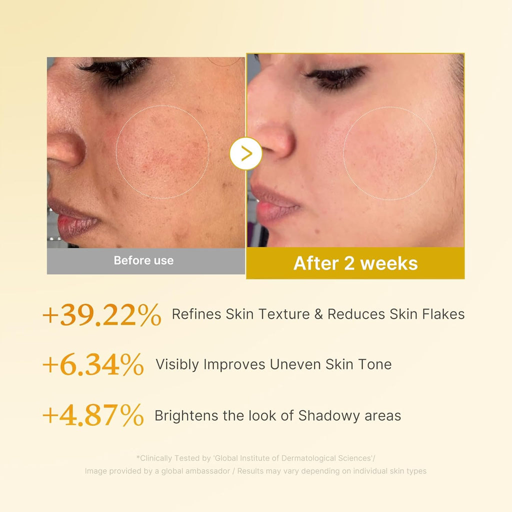 Medicube Kojic Acid Turmeric Resurfacing Toner [250ml]