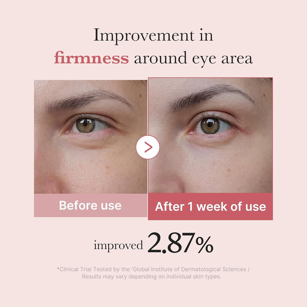 Medicube PDRN Pink Peptide Eye Cream [30ml]