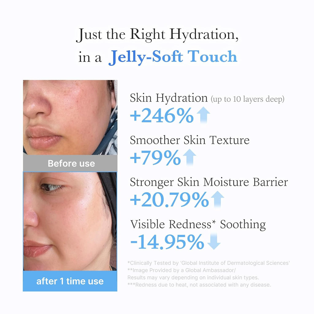 Medicube Hyaluronic Ceramide Jelly Cream [50ml]