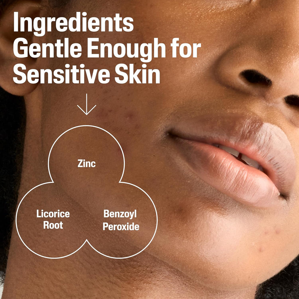 Cetaphil Gentle Clear Complexion Clarifying BPO Acne Cream Cleanser – 124ml