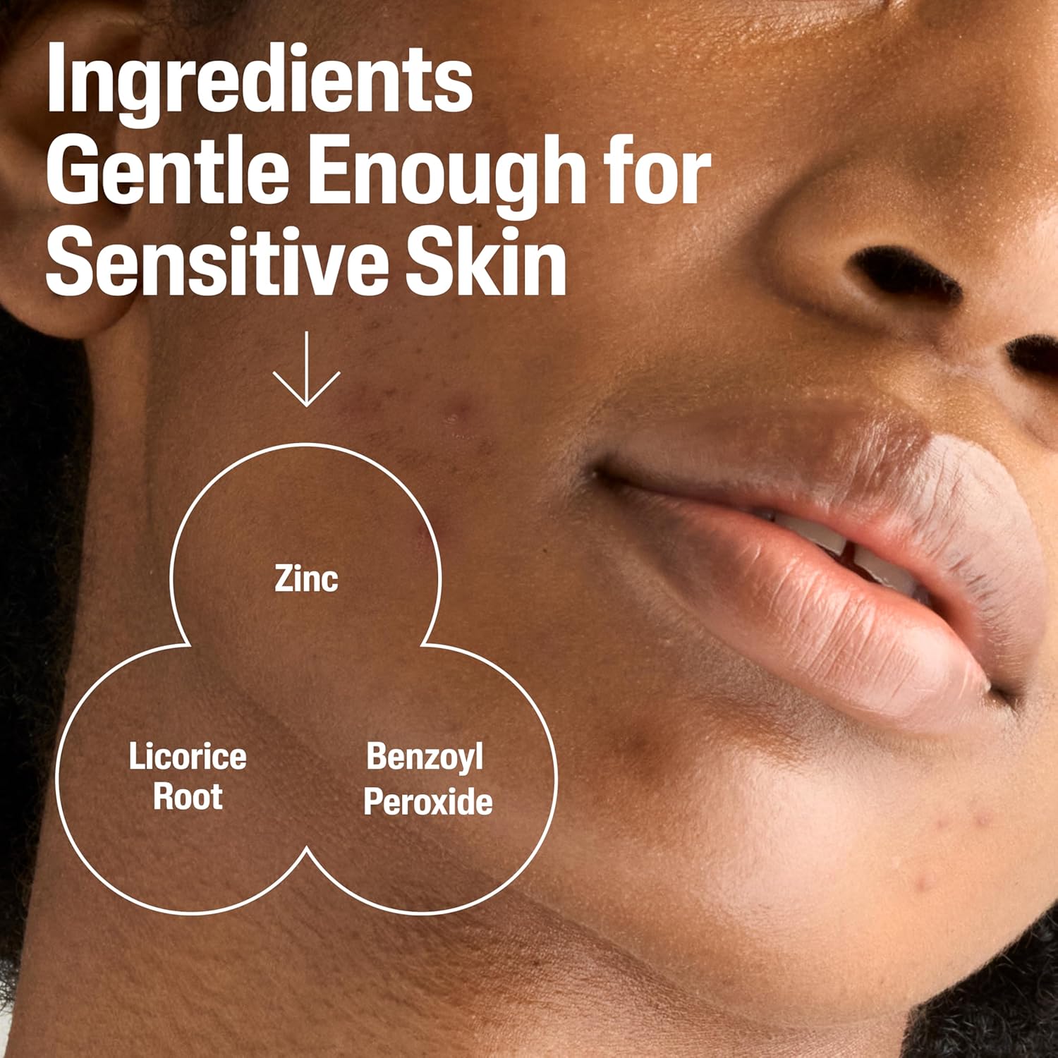 Cetaphil Gentle Clear Complexion Clarifying BPO Acne Cream Cleanser – 124ml