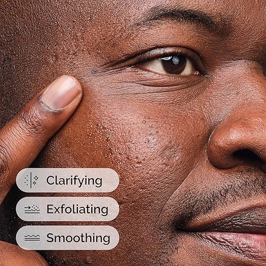 The Ordinary Salicylic Acid 2% Solution – 30ml