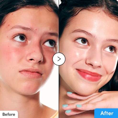 EQQUALBERRY Hyaltoin Flooding Serum 30ml